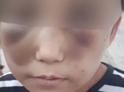 «Била скалкой»: на Левобережье в Волгоградской области 8-летняя девочка попала в больницу после жестокостей мачехи 