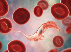 42-летний житель Волгоградской области скончался от поражения организма паразитами