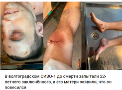 Журналисты опубликовали фото с последствиями пыток в волгоградском СИЗО, - «Блокнот Волгограда»