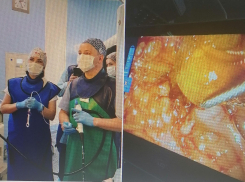 Пациентке с желчекаменной болезнью волгоградские хирурги провели уникальную операцию