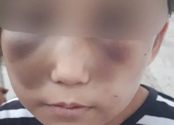 «Била скалкой»: на Левобережье в Волгоградской области 8-летняя девочка попала в больницу после жестокостей мачехи 