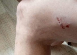 Мою знакомую искусала стая собак: как нам избавиться от этого зверья? - камышанка