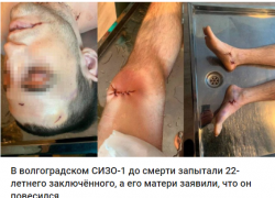 Журналисты опубликовали фото с последствиями пыток в волгоградском СИЗО, - "Блокнот Волгограда"