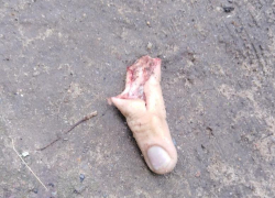 Камышане выложили в соцсетях снимок... оторванного человеческого пальца