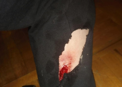 В Камышине в соцсетях под снимком о покусанном бродячими псами школьнике закрыли комментарии из-за всплеска негодования горожан